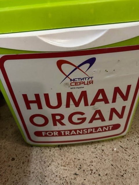 В Одессе успешно трансплантировали две почки и сердце – спасли жизнь трех пациентов