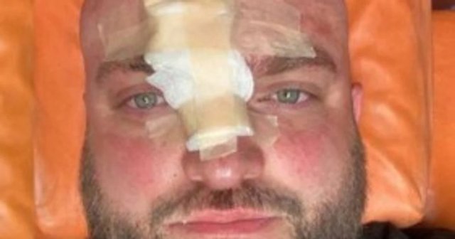 У Затоці чоловік побив військового металевою палкою через зауваження щодо російської музики